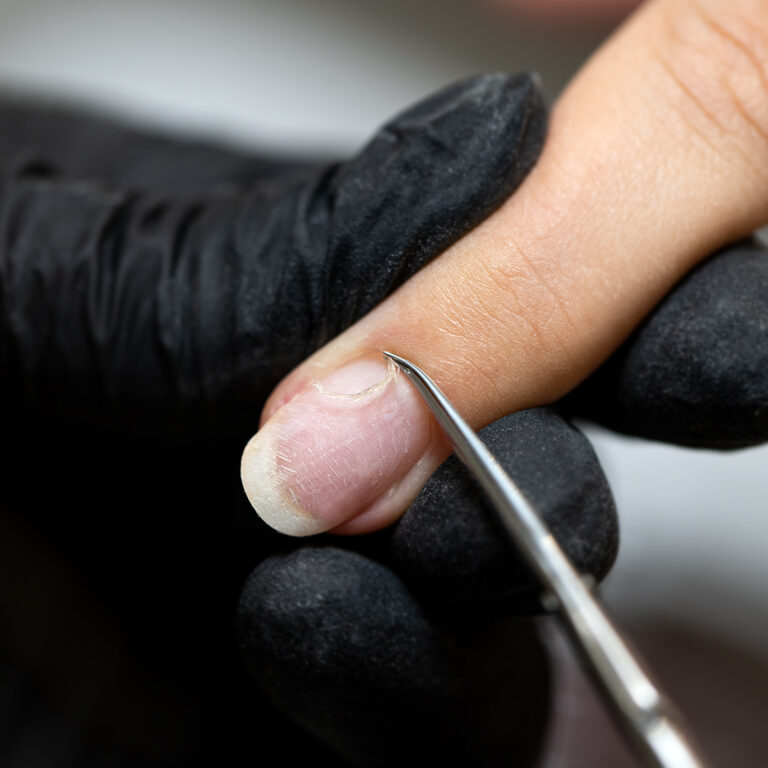Cuticules des ongles : comment les retirer de vos mains et conseils à suivre